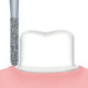 Restorative(For Preparation of crown cores)/S81D -AIR SCALER